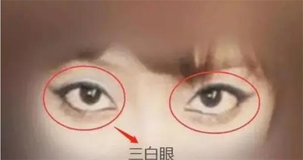三白眼男人面相分析 三白眼男人面相有什么含义