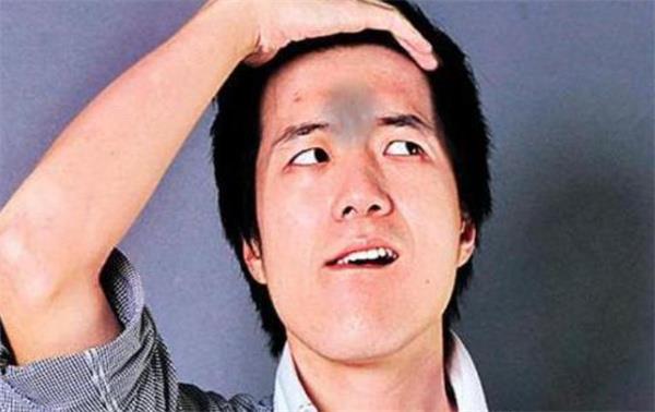 男人倒霉面相的特征 什么面相的男人比较倒霉