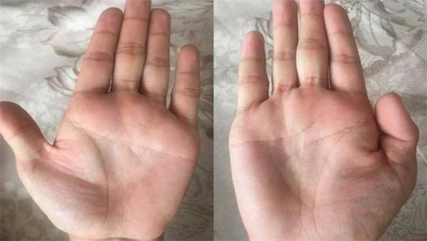 手掌厚实红润象征着什么 手掌心凹进去是否代表聚财