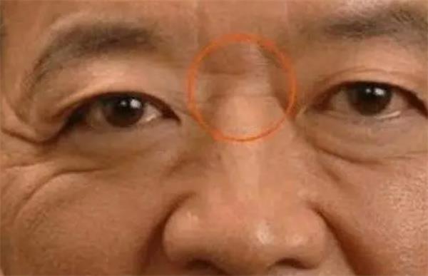  六亲缘薄的面相详解 六亲缘薄的面相有什么特征