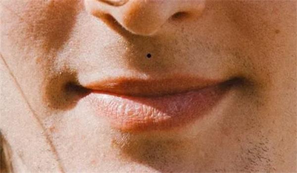 双生痣男人的财富运势 男人有双生痣命运是好还是坏