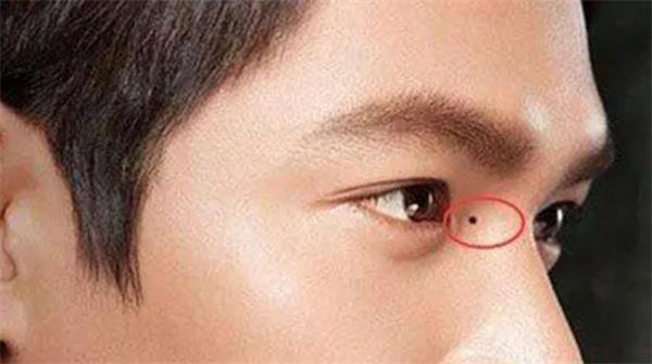 男孩眼角有颗痣好不好 男孩眼角有颗痣有什么说法