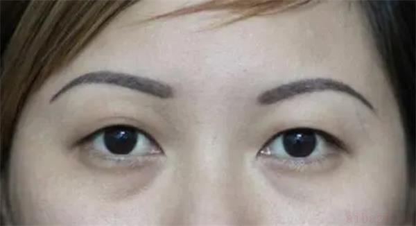 解读一双一单眼皮的人面相 一双一单眼皮的人面相怎么样