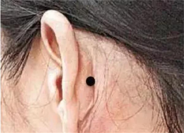 耳朵长痣有什么讲究 耳朵长痣有没有福气