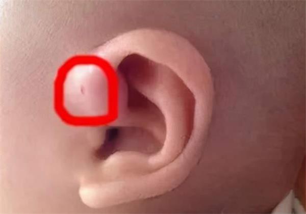 耳朵看小孩是否聪明详解 耳朵怎么看小孩是否聪明