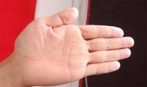 详细介绍掌暖气旺的手相特征 掌暖气旺的手相有何特征