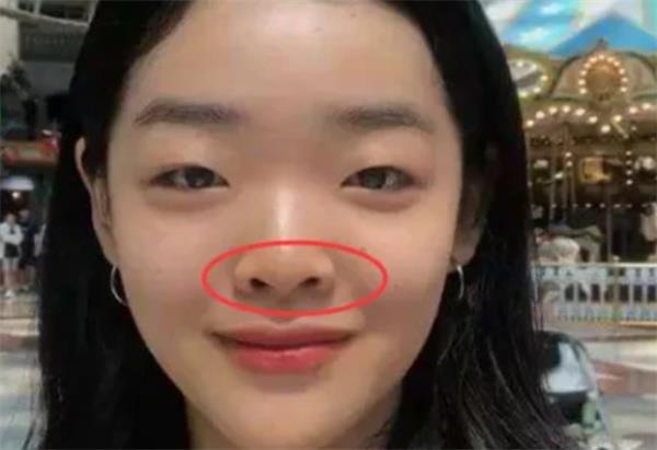 面相中草莓鼻的性格感情运势情况 面相中草莓鼻如何有什么说法