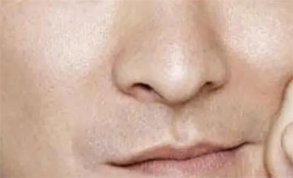 解读面相中鼻子上有疤命运 面相中鼻子上有疤有什么含义