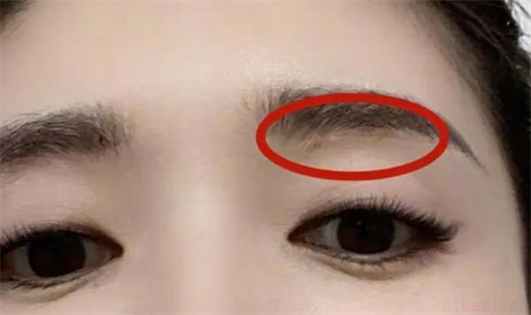 详谈眉毛有疤痕的人面相 眉毛有疤痕的人面相如何