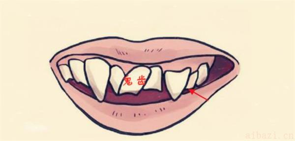 解读相学中有鬼牙的面相 相学中有鬼牙的面相说明什么
