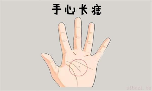 女人手心长痣的痣相分析 女人手心长痣如何