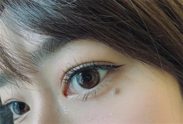 不同位置的泪痣讲解 不同位置的泪痣有什么寓意