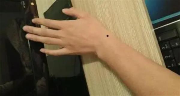 手腕有痣的人命运 手腕有痣代表什么