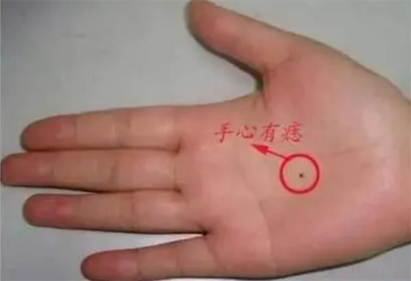 浅谈掌心有痣手相 掌心有痣手相好吗